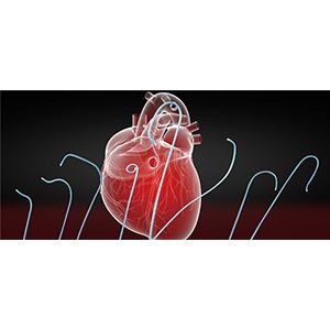 Angiographic Catheter